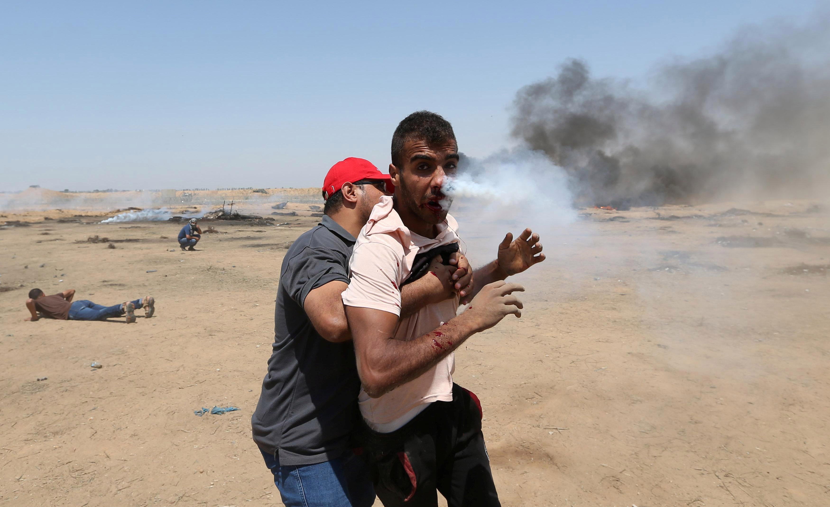 اصابة هيثم أبو سبلة بقنبلة غازية أثناء مسيرات العودة في غزة، 8 يونيو 2018. ابراهيم أبو مصطفى/ رويترز