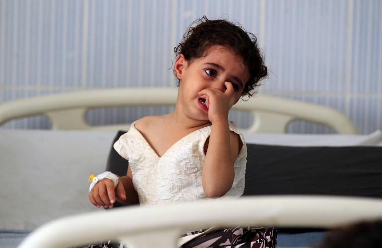 طفلة يمنية تصرخ وهي جالسة في مستشفى بالعاصمة صنعاء، 31 أكتوبر 2018. محمد حويس/ أ ف ب