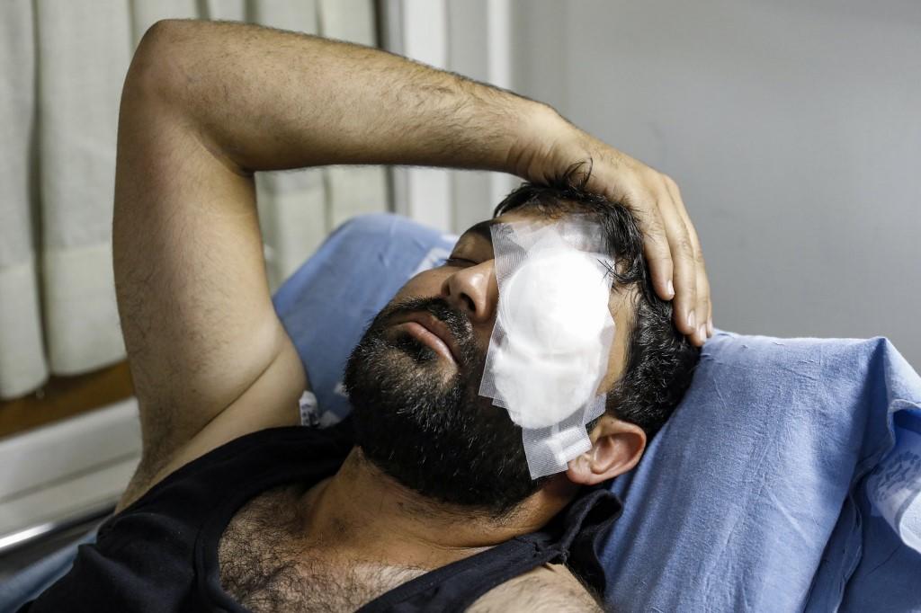 المصور الصحفي الفلسطيني معاذ عمارنة في مستشفى بعد إصابته في عينه. (أحمد غرابلي/ المملكة)