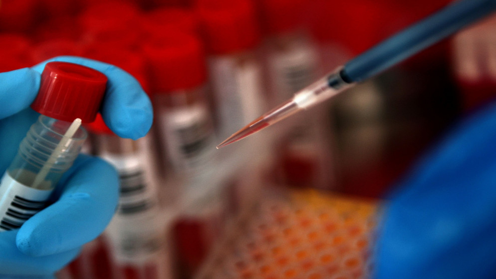 عينات فحص الكشف عن فيروس كورونا المستجد في مختبر في فيينا في النمسا، 6 تشرين الأول/أكتوبر 2020. (رويترز)