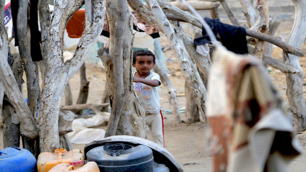 طفلة تعاني من سوء التغذية الحاد ومضاعفات الحمى والإسهال في الحديدة في اليمن. (الأمم المتحدة)