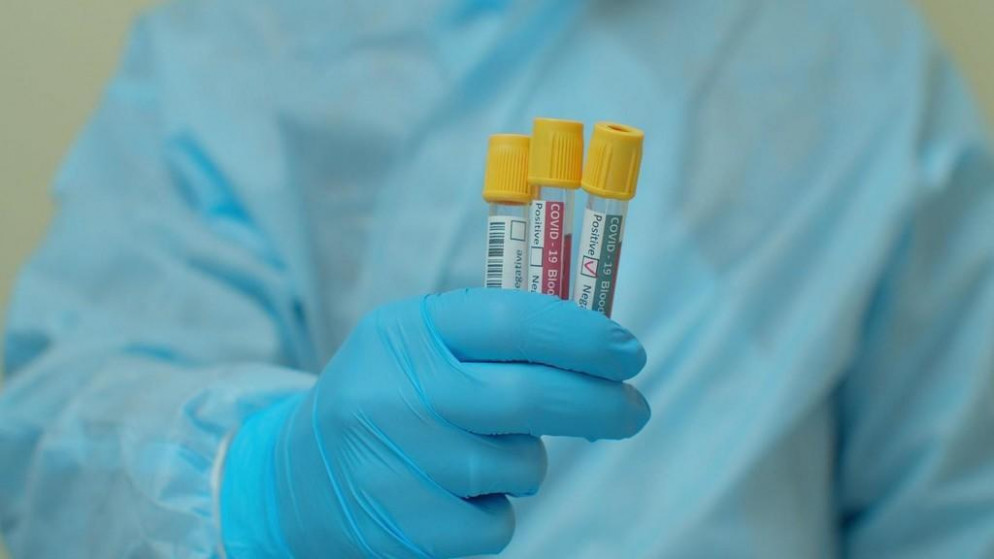 سيتم جمع عينات دم عشوائية على مدار  3 أيام. (Shutterstock)