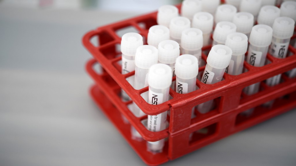 عينات فحص الكشف عن فيروس كورونا المستجد في مختبر في سانت نيك في فرنسا، 12 آب/أغسطس 2020. (أ ف ب)