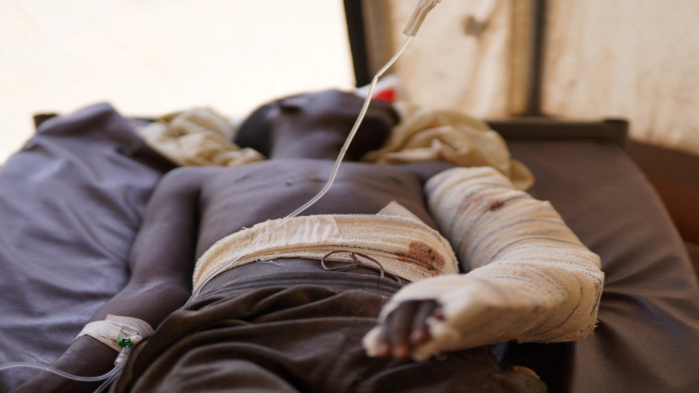 يتلقى رجل سوداني مصاب فر من العنف في الفاشر العلاج في عيادة مؤقتة شمال دارفور. السودان. 3 تشرين الثاني 2025. (رويترز)