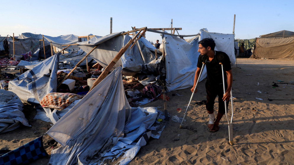 فلسطيني مصاب جراء العدوان الإسرائيلي على قطاع غزة ينظر باتجاه خيم تؤوي نازحين في خان يونس جنوبي قطاع غزة. 5 آب 2025. (رويترز)