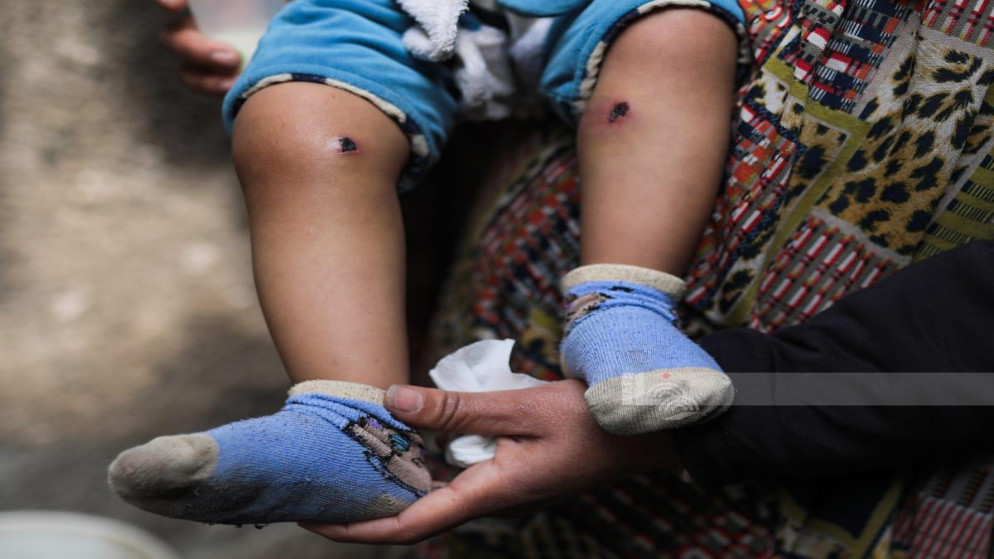 غزة.. خطفوه وأباه وأعادوه بأقدام محروقة