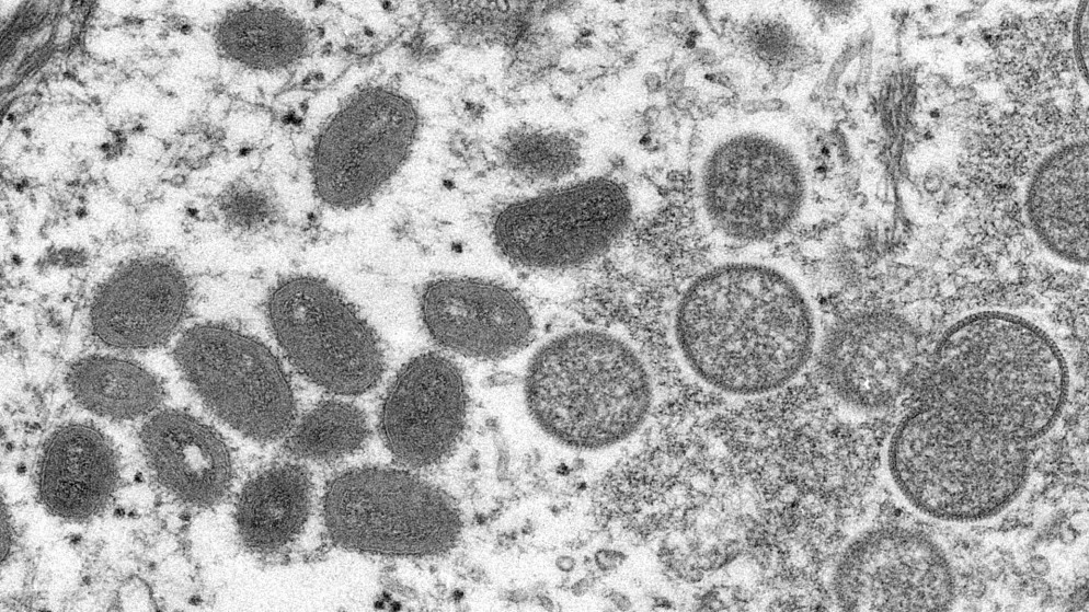 صورة مجهرية لجزيئات فيروس جدري القردة، 18 أيار/مايو 2022. (رويترز)